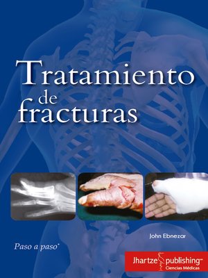 cover image of TRATAMIENTO DE FRACTURAS